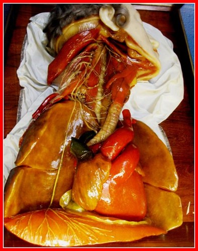 An anatomical model of the human heart, representing cardiovascular context